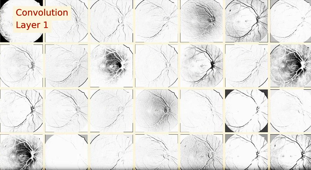 First convolution layer activations on retina images from the diabetic retinopathy model